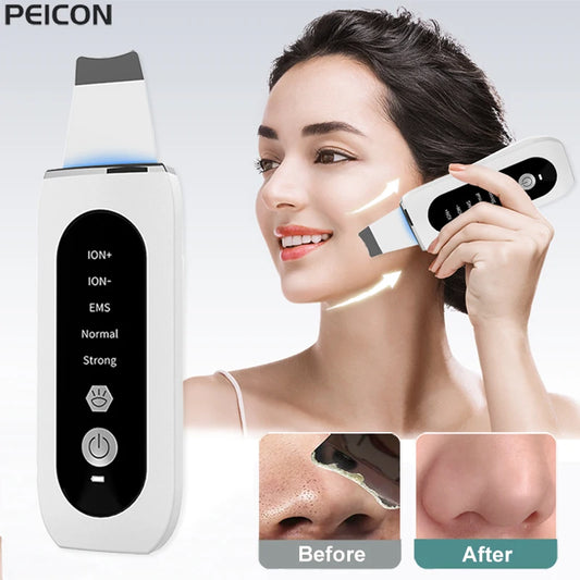 Ultrasonic Skin Scrubber Remover Deep Face Cleaning